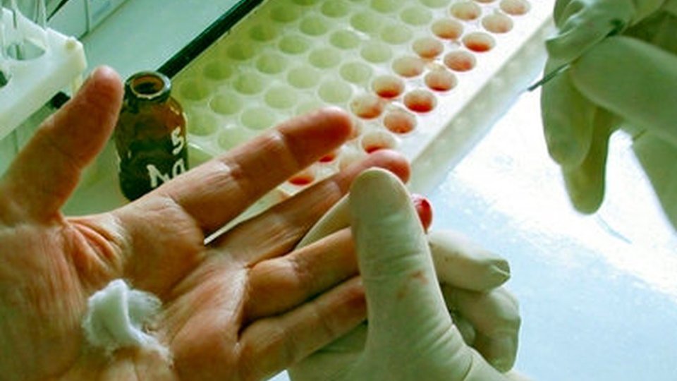 Trei focare de hepatită virală de tip A, confirmate în județul Brașov
