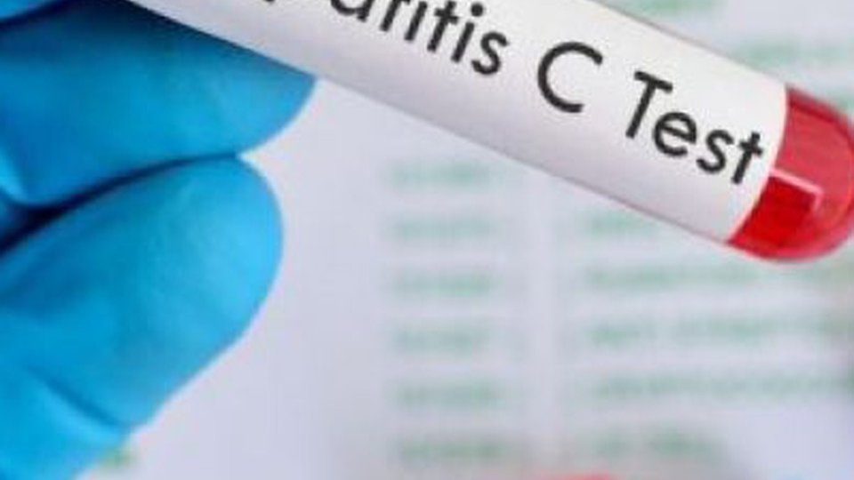 CNAS, noi contracte pentru tratamentul hepatitei virale cronice C