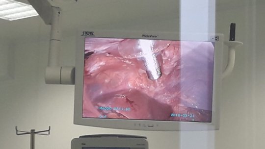 O operație în premieră pentru Europa de Est, la un spital privat din Braşov