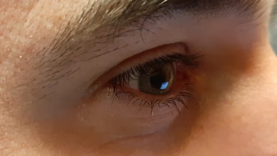 Mai mulți elevi, de la Şcoala Gimnazială Nr.11 Ştefan Octavian Iosif din Brașov acuză arsuri și usturimi la ochi, din cauza unei lămpi cu ultraviolete