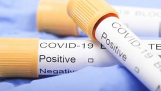 Încă 1.500 de teste COVID-19 pentru Spitalul de Boli Infecțioase din Brașov
