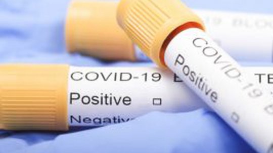 Ministerul Sănătății a aprobat creșterea numărului de persoane testate