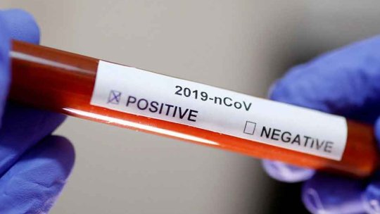 Peste 173 de mii de teste COVID-19, prelucrate la Brașov