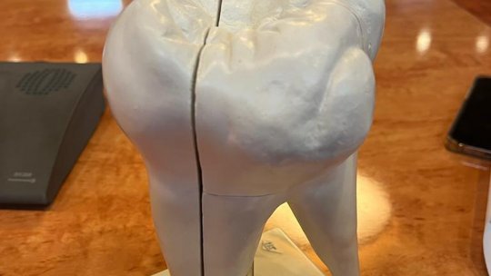 S-a dat startul programului pilot de sigilare gratuită a molarilor de 6 ani pentru copiii din clasele pregătitoare din oraș