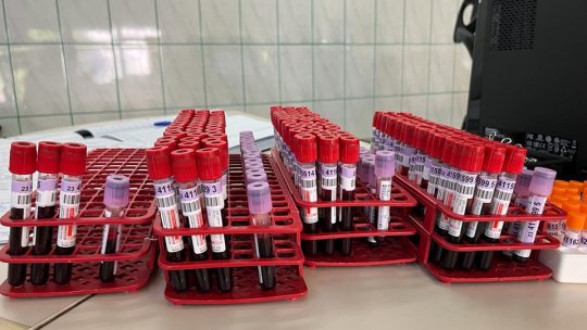 Mai mulți donatori de sânge odată cu creșterea valorii tichetelor