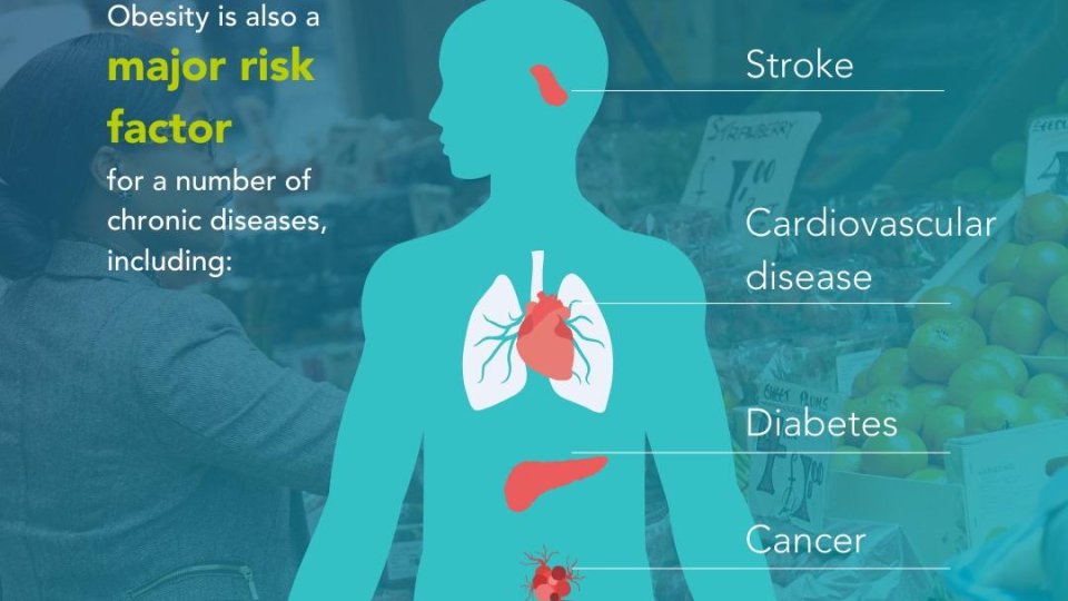 Un sfert dintre copiii României suferă de obezitate