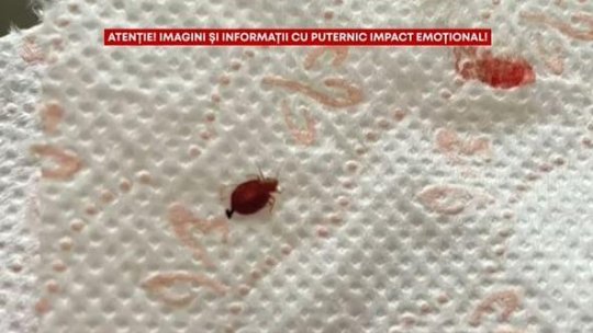 În loc de o vacanță reușită la munte, un coșmar cu mușcături de ploșnițe